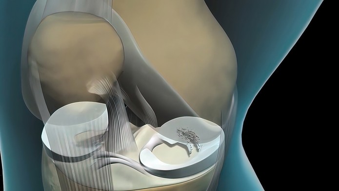 3D Illustration of Knee Ligaments