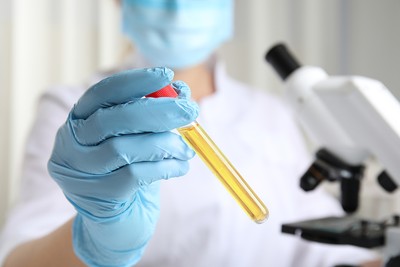 Doctor Holding Urine Sample in Lab