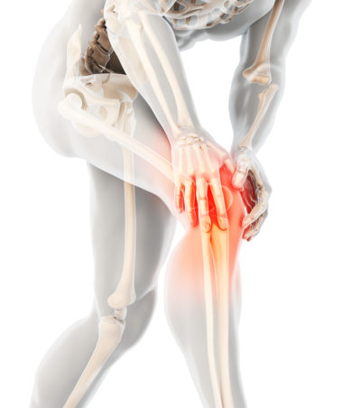 Skeleton with Injured Knee